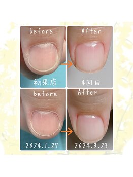 オンシジューム(Oncidium)/自爪育成中【2ヶ月の変化】