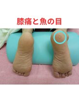 ナカザワ(NAKAZAWA)/膝の痛みと魚の目の関係・1