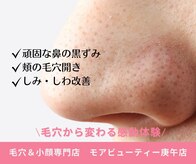 モアビューティー 庚午店(MORE BEAUTY)