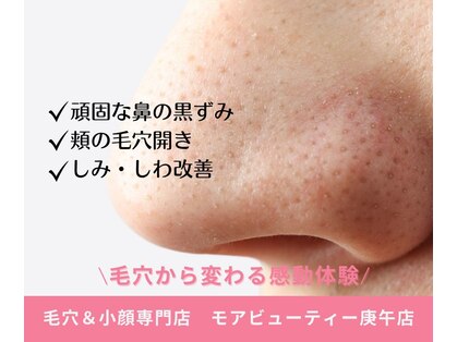 モアビューティー 庚午店(MORE BEAUTY)の写真