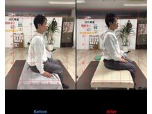 ストレチックス 近江八幡店/BeforeAfter