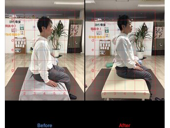 ストレチックス 近江八幡店/BeforeAfter