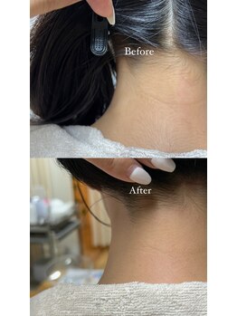 ルモア(Lumor)/レディース｜うなじWax