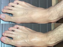 ハナワクシングプラス 高知(HanaWaxing+)/【台湾式足つぼ】