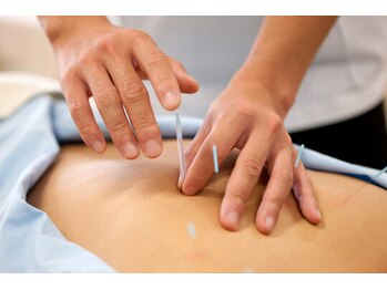 杜の鍼灸院/腰痛には体の深部へアプローチ