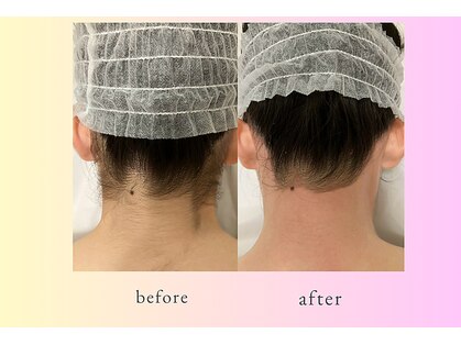 ワクシングサロン ツィター(Waxing salon zither)の写真