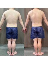 パラディ(PARADIS)/【40代男性】リバウンド後