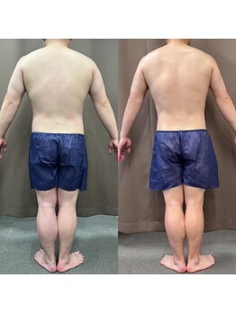 パラディ(PARADIS)/【40代男性】リバウンド後