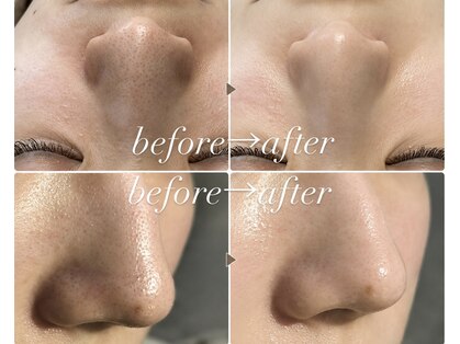 アールイービューティスタジオ(RE BEAUTY STUDIO)の写真