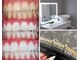 リュシオル(Luciole)の写真