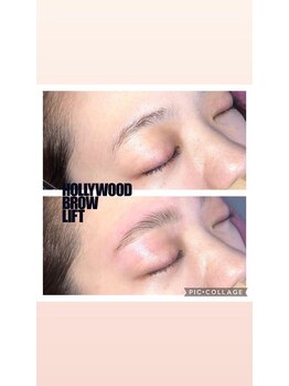 ベニ(BENI)/ハリウッドブロウリフト