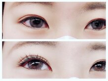 ビタミン(Vitamin*)/