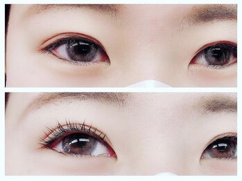 ビタミン(Vitamin*)/