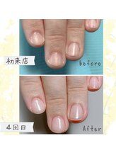 オンシジューム(Oncidium)/自爪育成中【2ヶ月の変化】