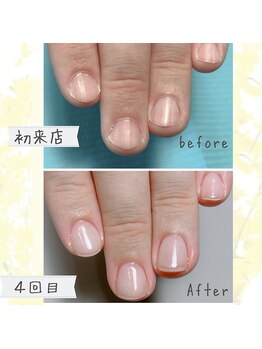 オンシジューム(Oncidium)/自爪育成中【2ヶ月の変化】