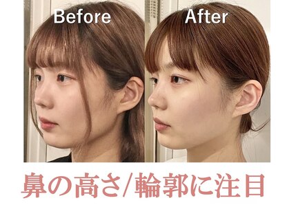 ラプリ 横浜店(Raplit)の写真
