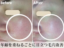 エルエルシー(L.L.C)