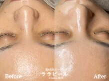 リル 和歌山市店(lilou)の雰囲気（圧倒的ツヤ肌になれる！ララピール☆）
