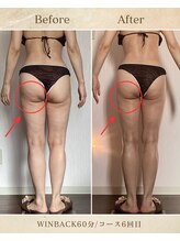 エソール(essor)/ヒップアップでキレイなお尻に☆