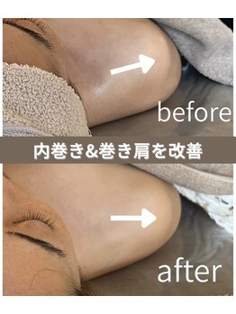 カムズ ビューティー(COMES BEAUTY)/肩こり改善リンパマッサージ