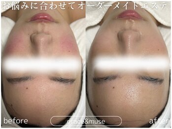 グレイス アンド ミューズ(grace&muse)/お悩みに合わせてプランをご提案