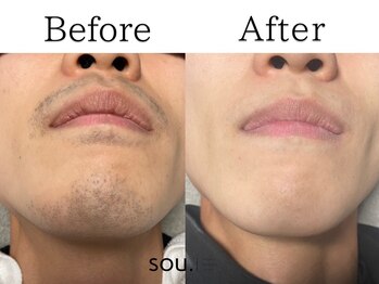 ソウ 越前店(sou.)/