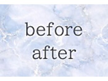 ホワイトニングカフェ 黒崎店(WhiteningCafe)/◎症例写真◎