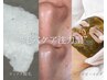【毛穴ケア注力型】鼻WAX＆肌質改善エステで一気にタマゴ肌へ！¥9900/1回限り