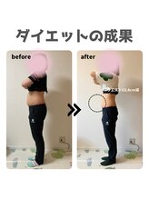 ファミール鍼灸整体院(famille鍼灸整体院)/体重マイナス11.2kg