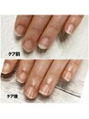 【ネイルケア】