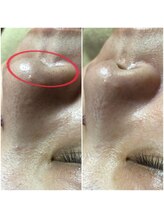 エステルーム クリスタル/贅沢たっぷりフルコース