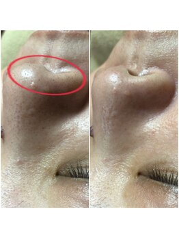 エステルーム クリスタル/贅沢たっぷりフルコース