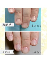 オンシジューム(Oncidium)/自爪育成中＾＾