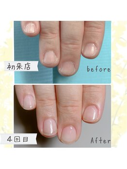 オンシジューム(Oncidium)/自爪育成中^^