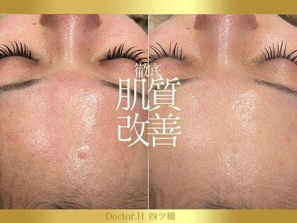 ドクターエイチ 四ツ橋堀江店(Doctor.H)の写真