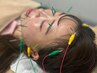 【たるみが気になる】美容鍼(30分)＋ヘッドマッサージ(20分)