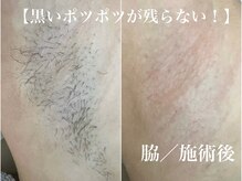 ソワン(soin)