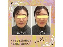 水素酸素混合ガスは整体やジムなどでも導入が進む実力派!