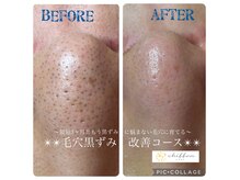 ひそかにリピーター続出の毛穴ケア！いつもピカピカ毛穴キープ♪