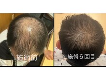 サロンモコ(Salon Moco)/【髪の毛のボリューム】