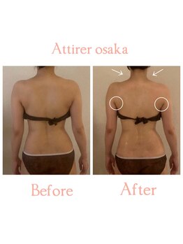 アティレ オオサカ(Attirer Osaka)/埋もれた首＆肩集中90分2回目