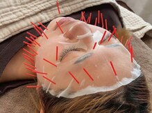 ボディコンシェル(Body Conciel)の雰囲気(肌質を改善して透明感のある若々しい印象へ◎)