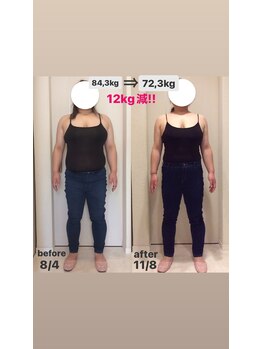 ホロニック ベルサンテ(Holonic Belle Sante)/メディセルハイブリッド