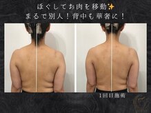 ヴェルナ(VELUNA)