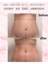 リラ(Lilas)/【痩身】ぽっこりお腹が！？