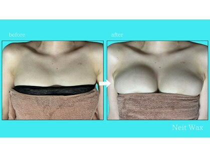ネイト ワックス(Neit Wax)の写真