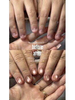 アムナネイルズ(amuna nails)の写真/脱コンプレックス!美爪育成ネイルサロン!