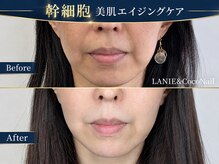 ラニー アンド ココネイル(LANIE&CocoNail)