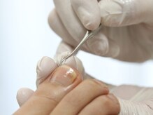 リフレリア(REFLERIA)/足爪周りのお掃除