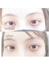 アイシック 勝どき(eyechic)/まつげパーマ/ラッシュリフト